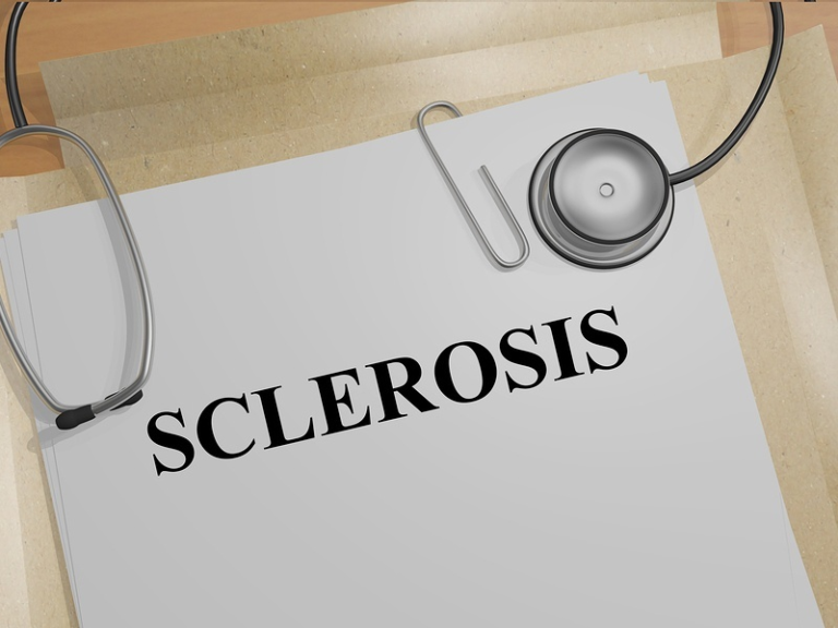 Sclerosis multiplex | Forradalmi gyógyszert engedélyeztek 1